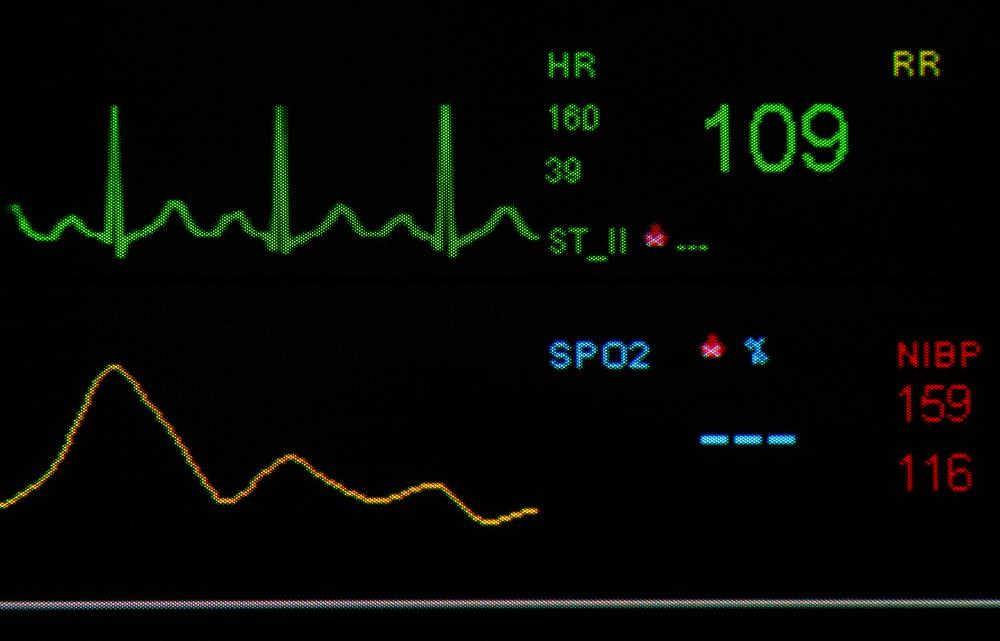 An irregular heart rate might be a sign of future heart trouble.