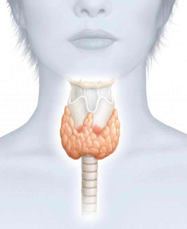 A thyroid storm usually creates many different symptoms.