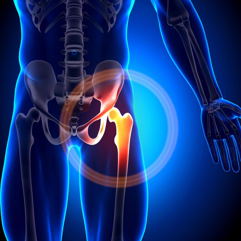 Hip injuries may cause groin pain.