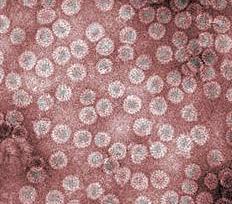 The HTLV virus is a retrovirus that suppresses the immune system.