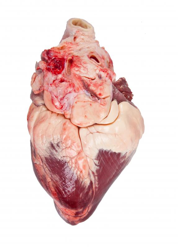 The heart works harder to pump blood during high blood viscosity.