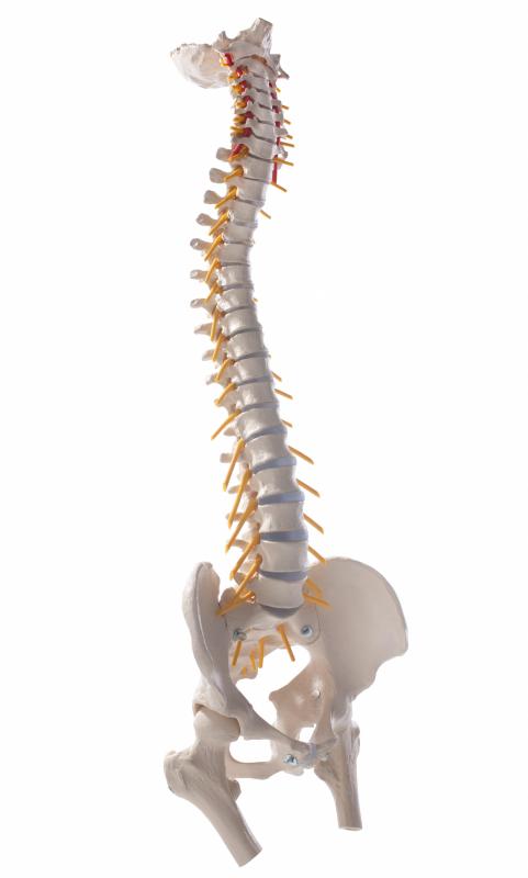 Spinal cord compression results in mild to severe pain.