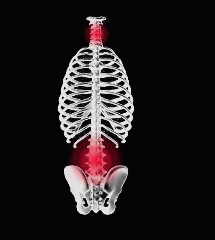 Symptoms of frontal neck pain can be difficult to diagnose, as there are many conditions that could lead to neck, jaw or spine pain.