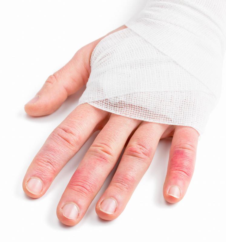 It is important to rest a swollen area.