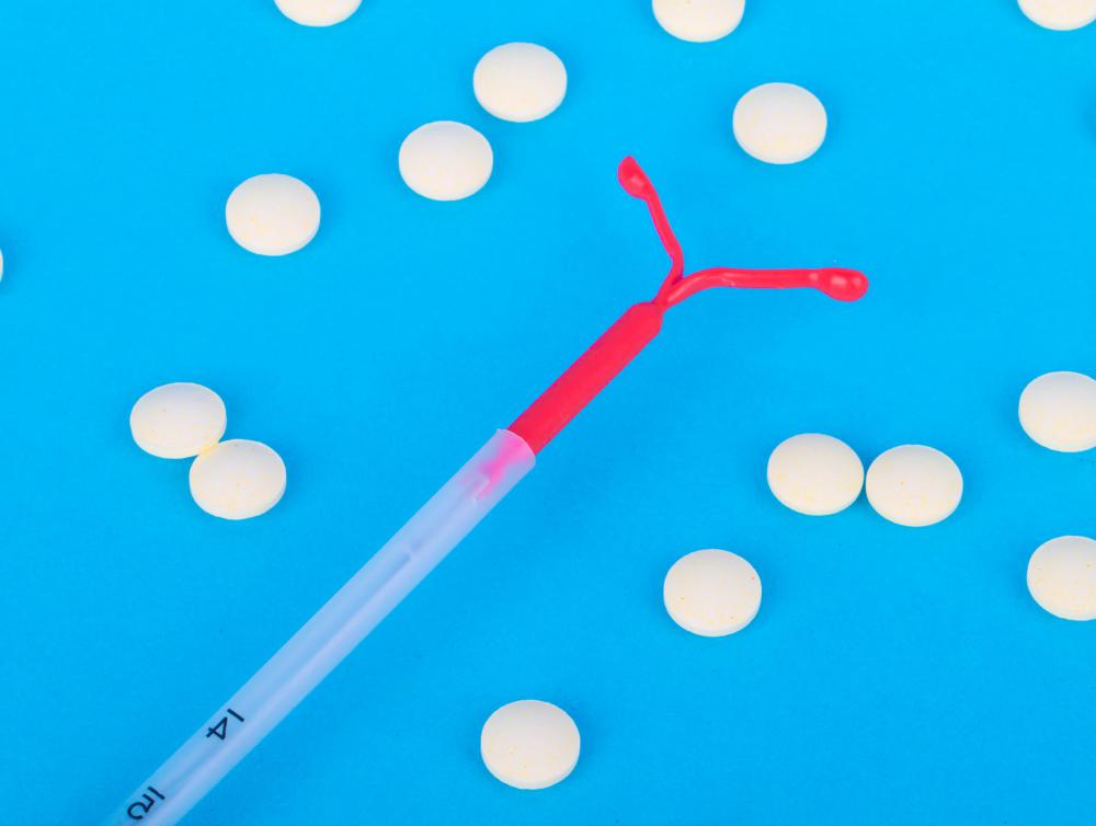 A contraceptive coil, also known as an intrauterine device (IUD), is a small, t-shaped device that is inserted vaginally and, in most cases, stays in place until removed by a doctor.