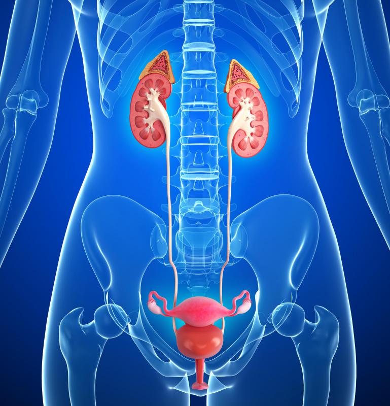 A Malecot catheter may be used during a procedure in which the bladder and nearby organs are removed.