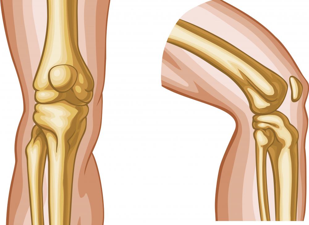 The medial collateral ligament (MCL) runs vertically to the inside of the kneecap.