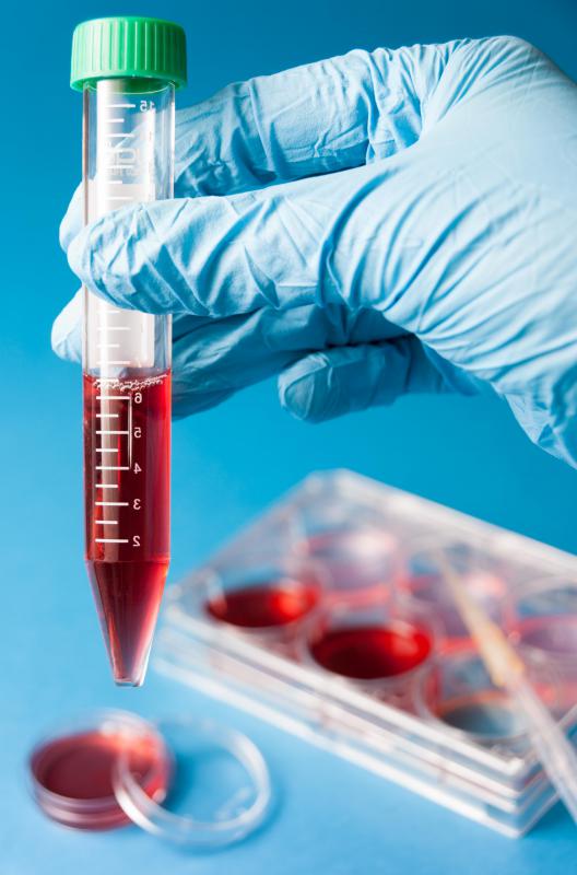 There are several lab tests that can assess the characteristics of an individual's red blood cells.
