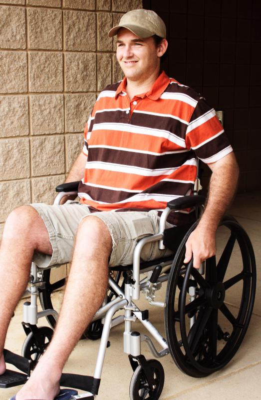 A severed spinal cord can result in paralysis.