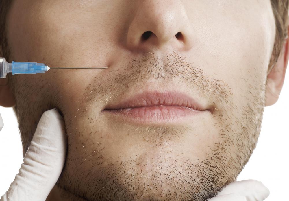 Botox is a possible form of treatment for synkinesis.