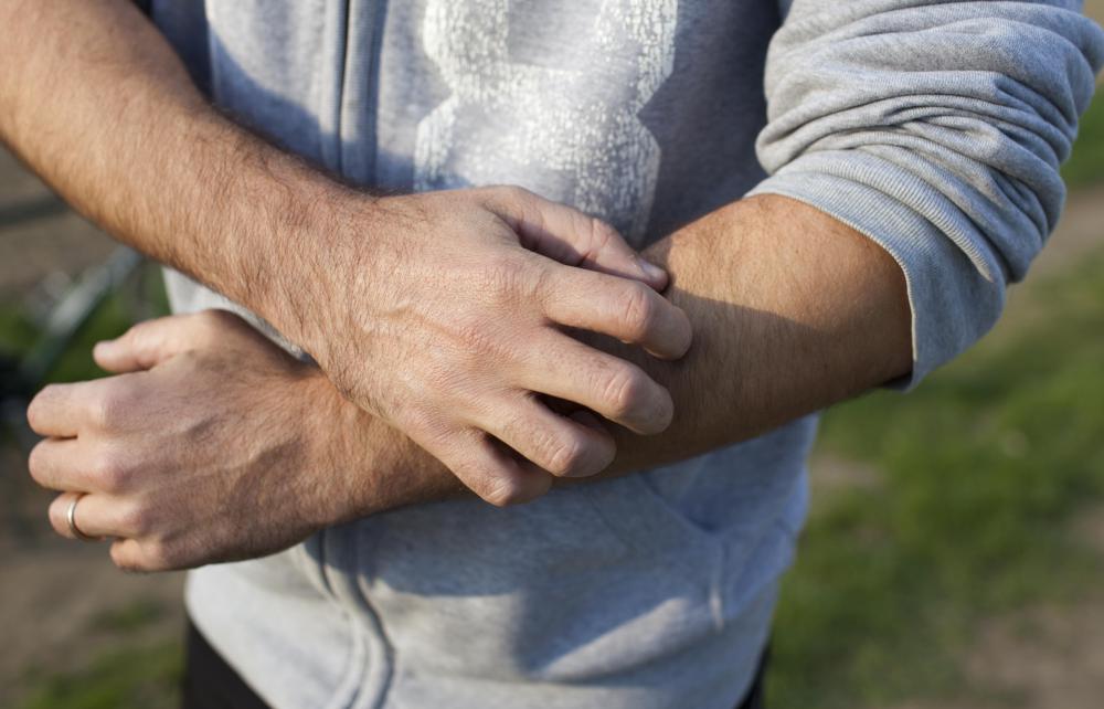 Itching could be caused by a variety of factors, such as an allergic reaction or bug bite.