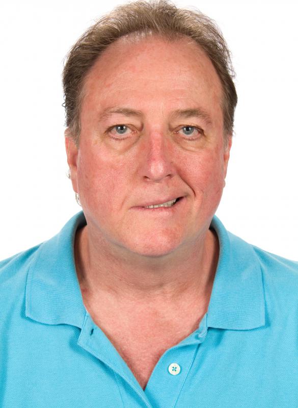 Bell's palsy is characterized by drooping of the face.