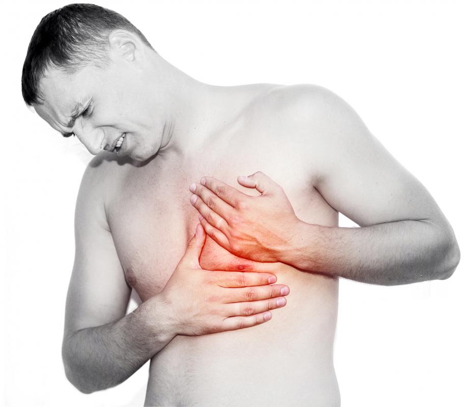 A papilloma may cause bloody discharge to emerge from the nipple.