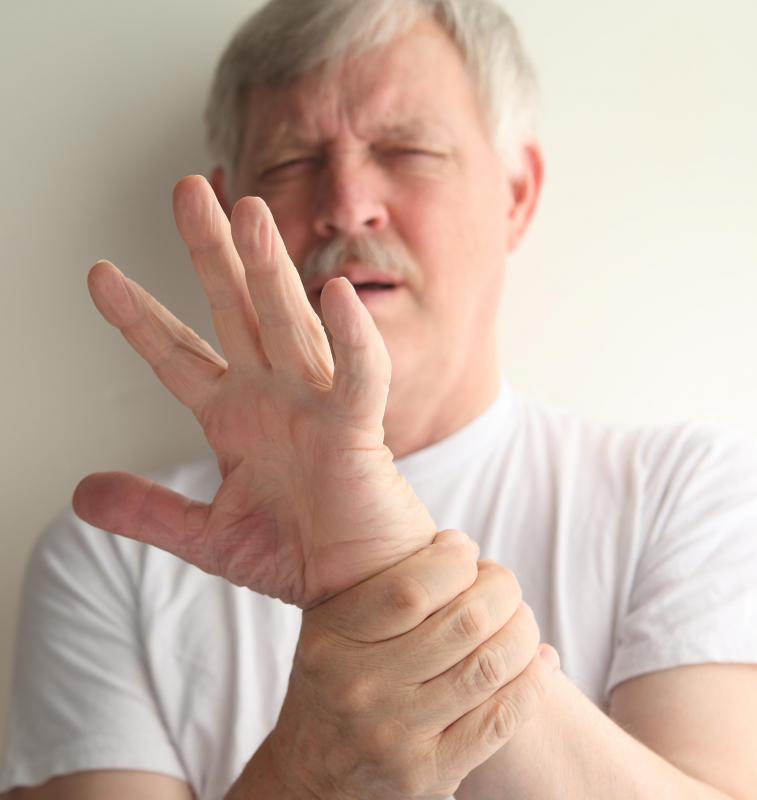 Sometimes a sprained hand can appear to be more greatly injured than it is.
