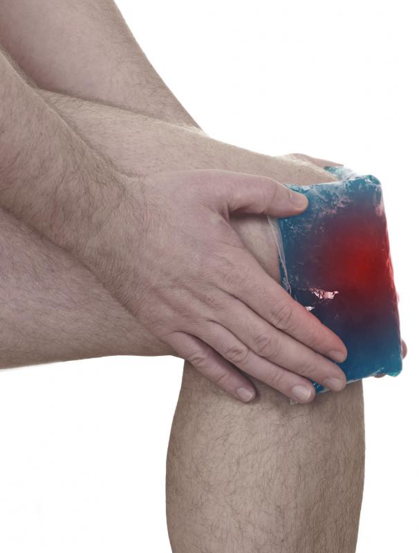 A cold compress may help alleviate pain associated with suprapatellar bursitis.
