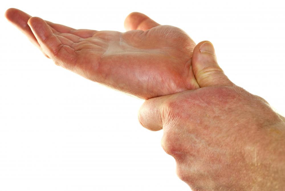 A man with a pinched nerve in his wrist.