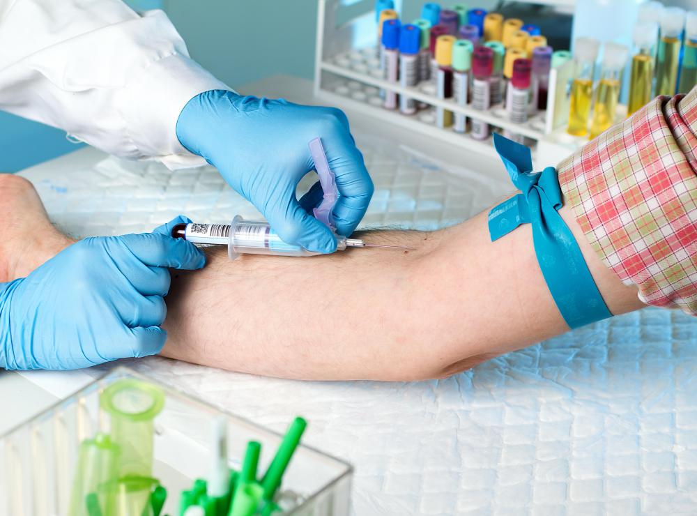 Venesection most commonly refers to the drawing of blood from a vein.