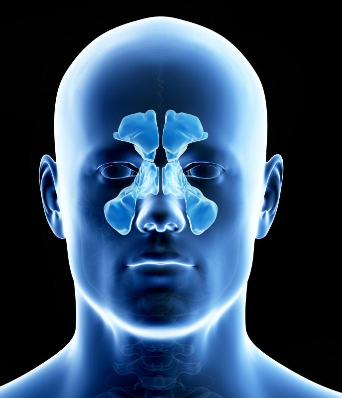 Nasal catheters may be used during sinus surgery.