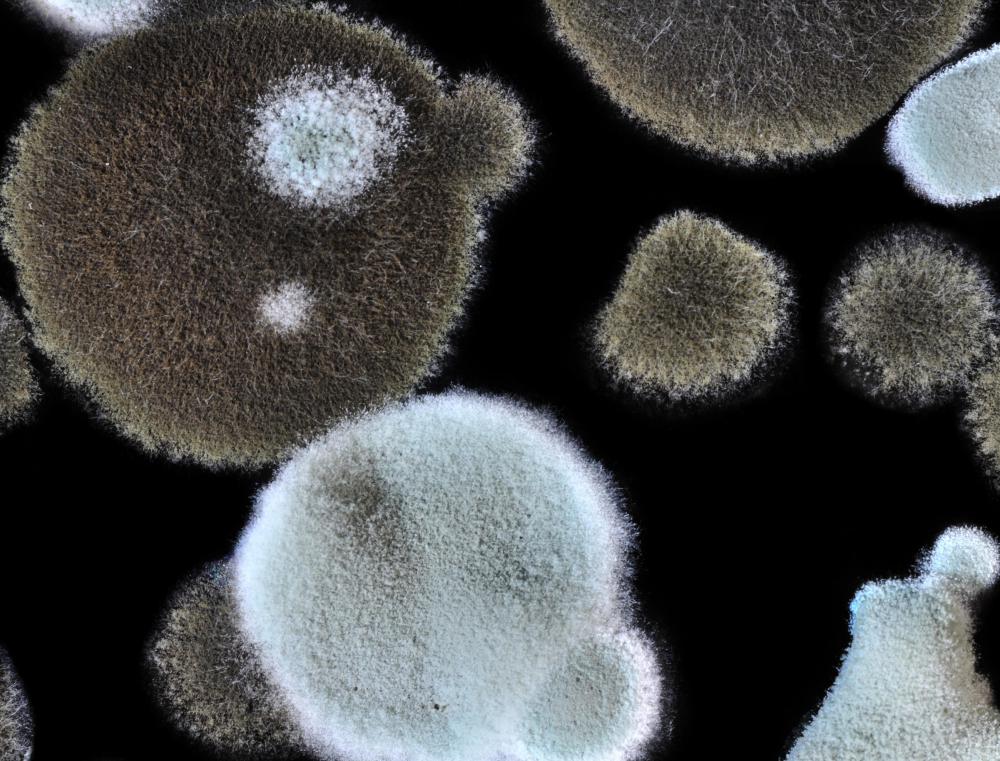 Most calcified granulomas are caused by fungal infections.