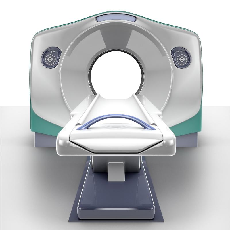 Magnetic resonance imaging scans reveal white matter foci.