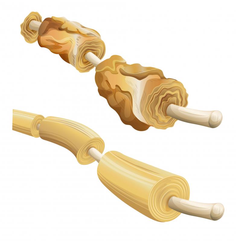 The myelin sheath that covers Class A and Class B nerve fibers can deteriorate due to heredity, poor nutrition, or viruses, leading to neurological disorders.