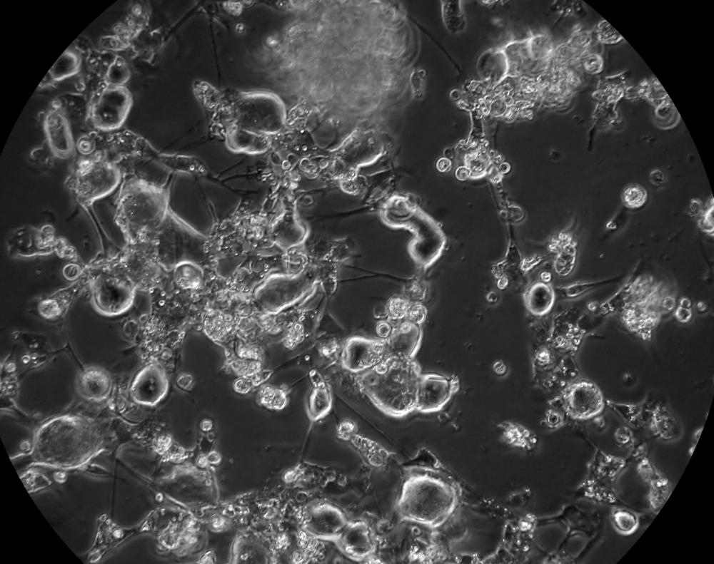 Neurons are the cells of the nervous system that transmit nerve impulses.