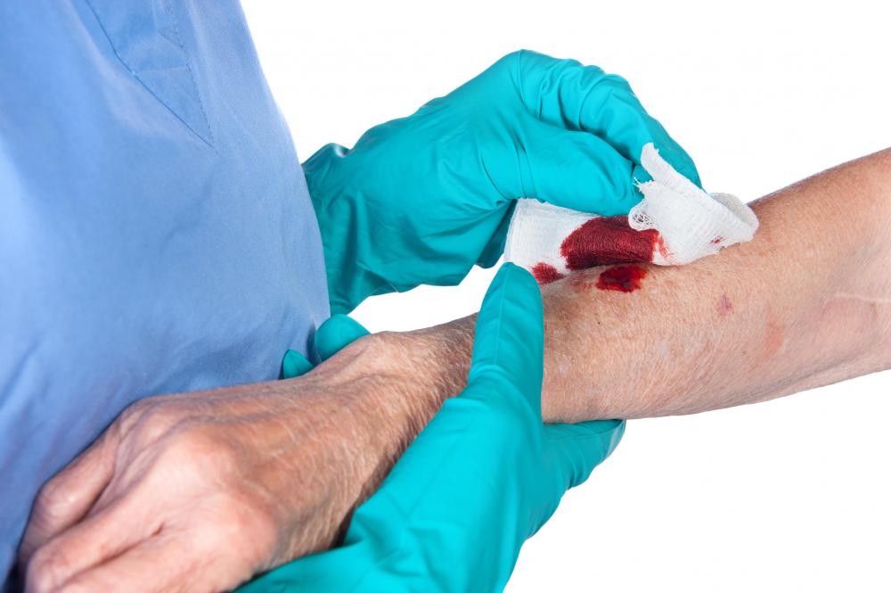 Wounds should be covered with sterile dressing, such as gauze.