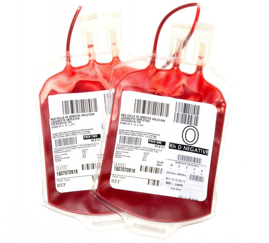 Two packs of O- blood.