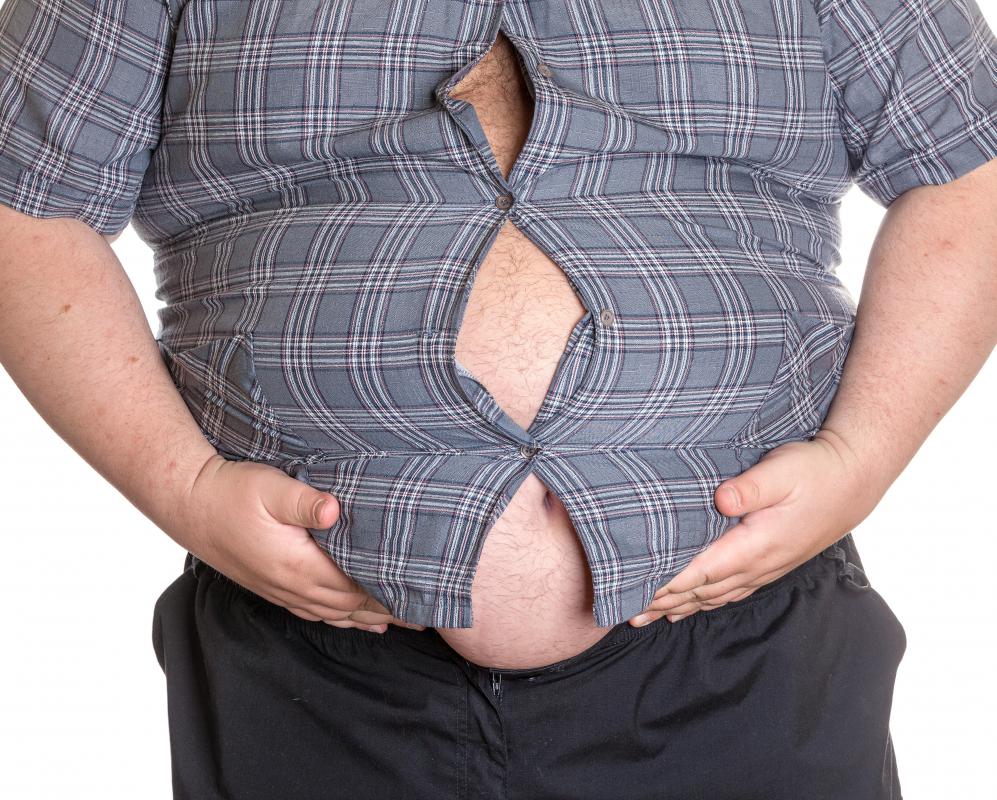 Obese individuals are at a high risk of developing cardiac hypertrophy.