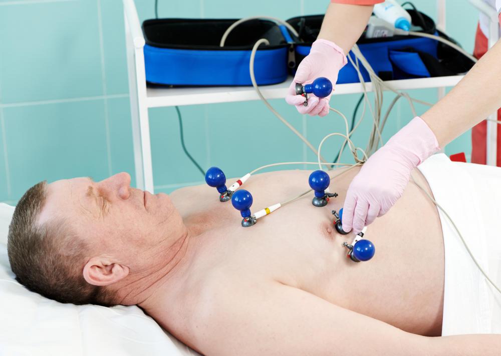 A left axis deviation is a common abnormality spotted on an electrocardiogram.