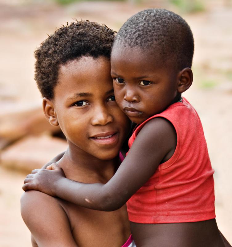 Umbilical hernias are common in boys of African descent.