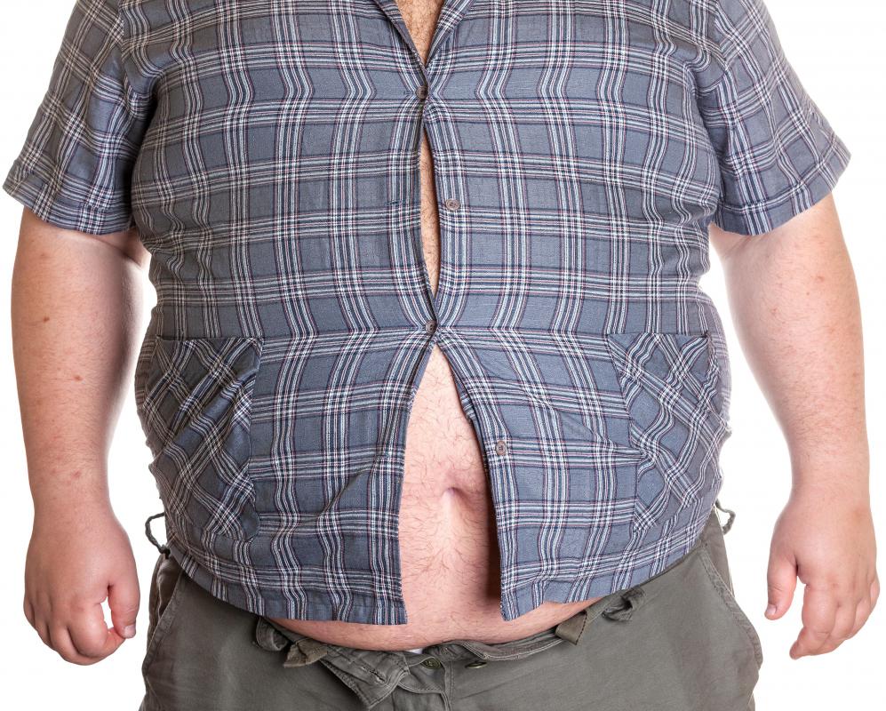 Morbidly obese people are at least 100 pounds over the recommended weight for their height.