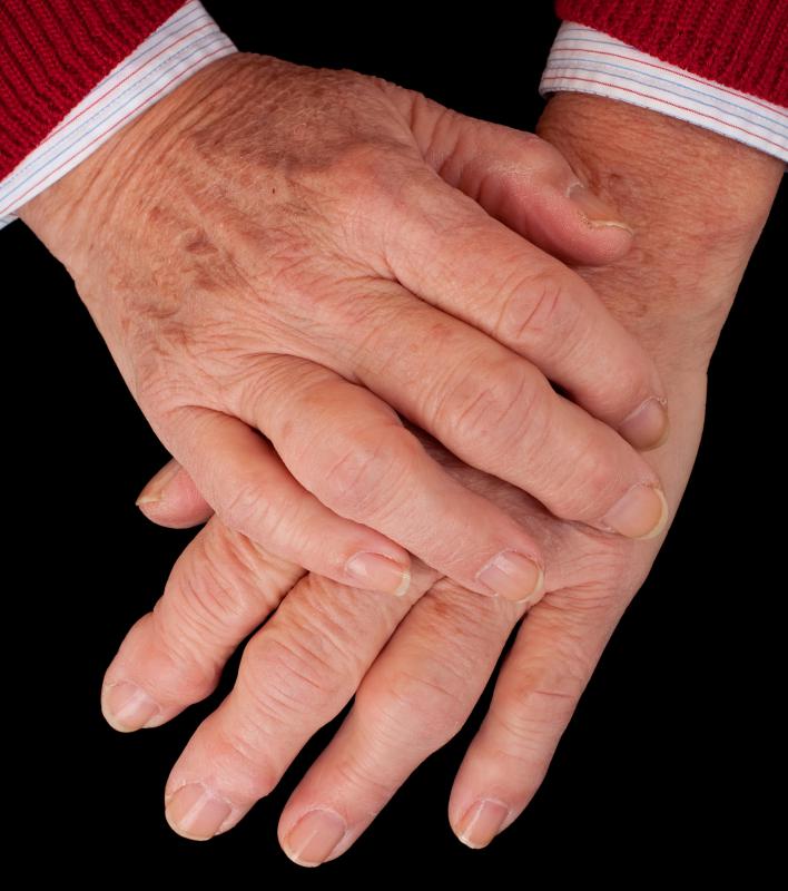 Certain types of medical conditions can cause knuckle swelling.