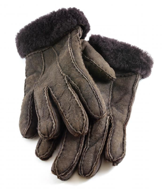Individuals who experience mottled skin should be especially careful to wear protective gloves and clothing when exposed to the cold and heat.