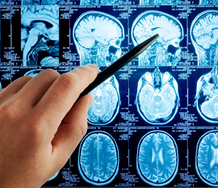 The brain's prefrontal cortex is responsible for regulating behavior, emotions and social control.