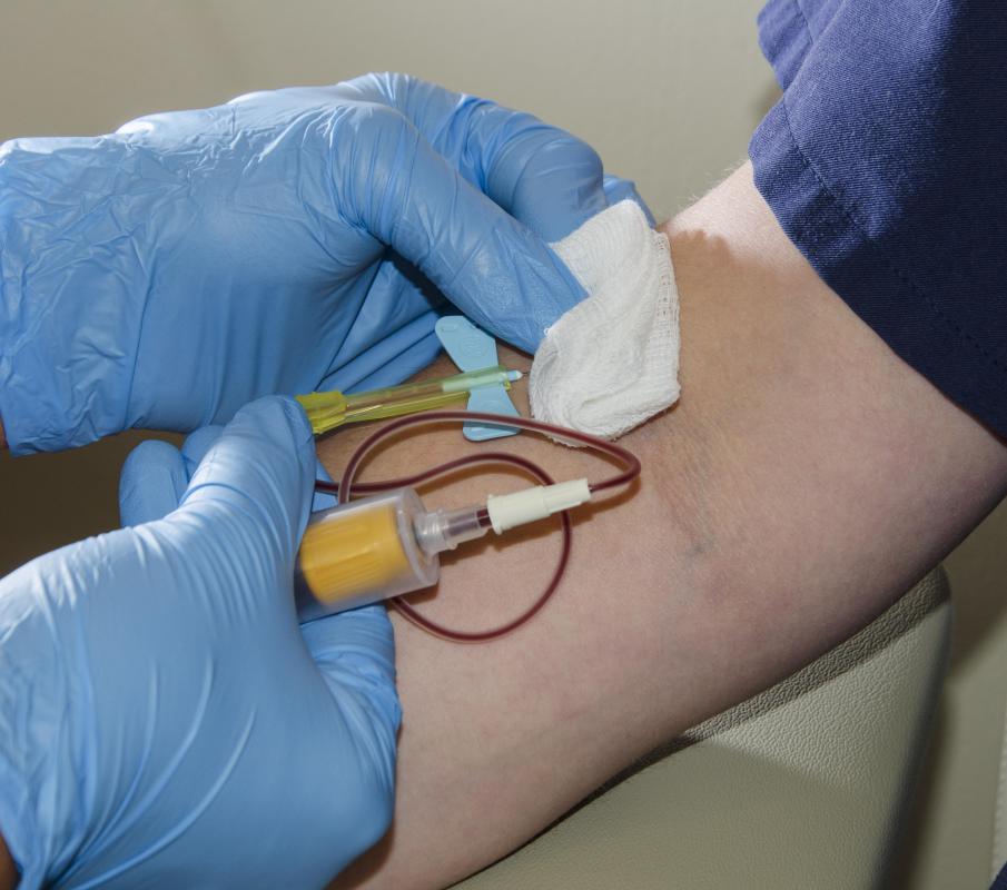 A lab can analyze blood to check for vancomycin peak and trough levels.