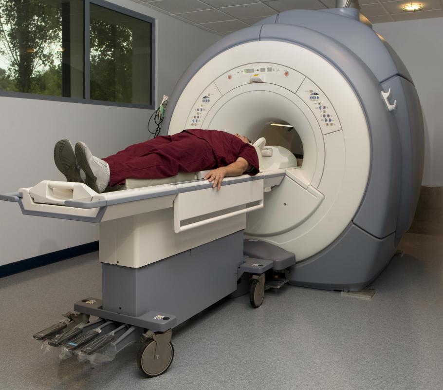 An MRI scan may be conducted if a doctor suspects that a woman has endometriosis.