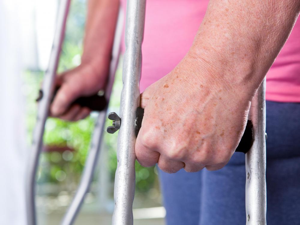 The use of crutches can help with mobility following a transfemoral amputation.