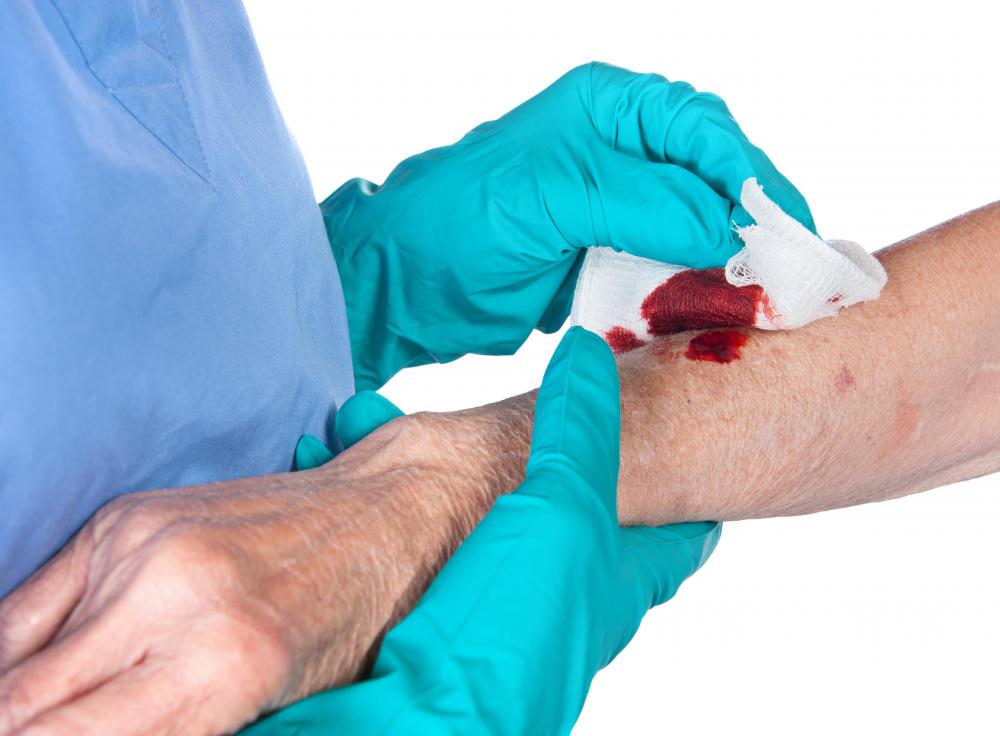 A wound care nurse may monitor a variety of wounds.