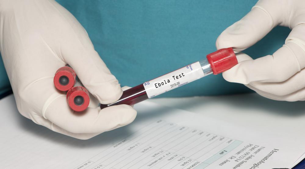 Hemorrhagic fevers such as Ebola may cause petechiae as an early symptom.