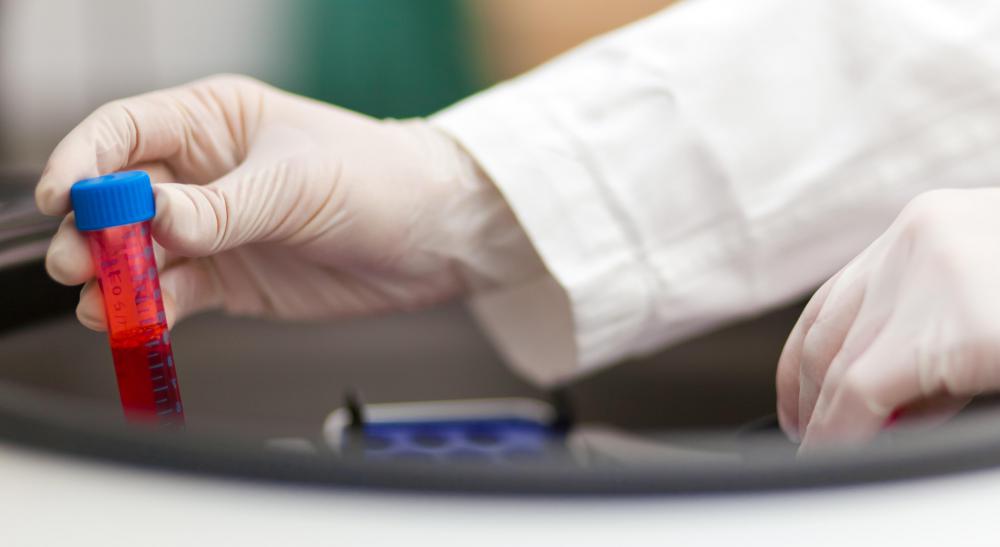 Many factors can cause a low white blood cell count.