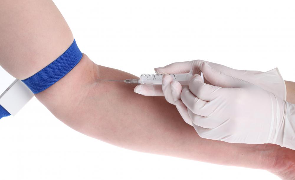 Blood is drawn first thing in the morning while fasting in order to provide sample to test for leptin levels.