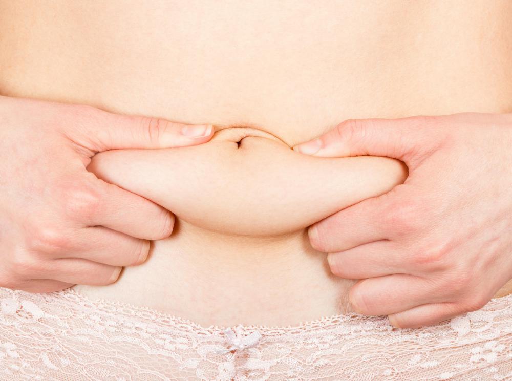 Side effects of fluocinolone acetonide cream may include weight gain.