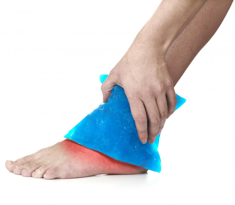 Ice is often part of the treatment for a sprained ankle, which causes puffiness.