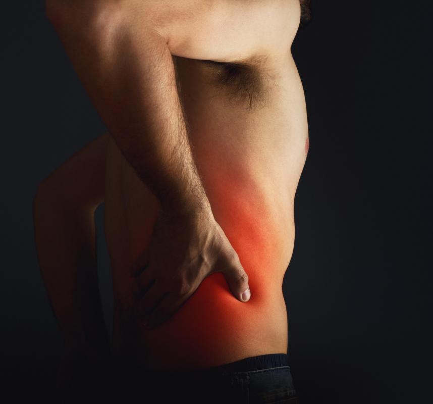 Symptoms of a pilonidal abscess include pain in the buttocks.