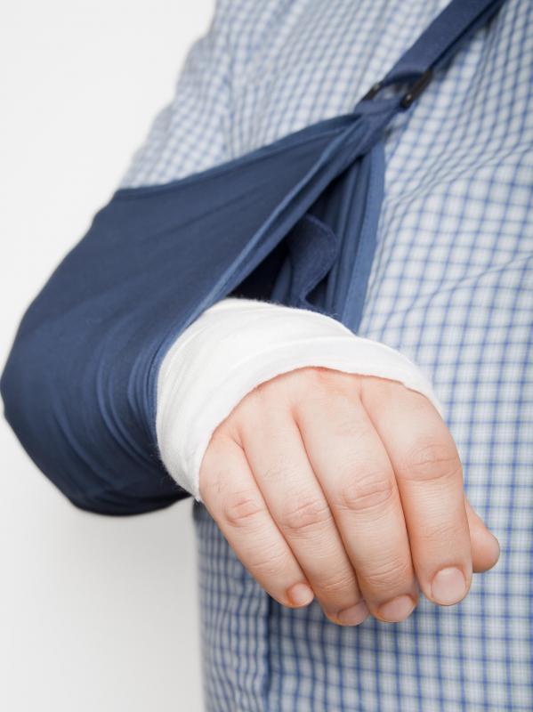 Fluoroscopy may be used to determine if a patient has broken bones.