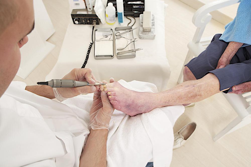 Chiropodist treating an elderly patient.