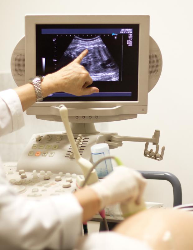 Doppler gel is smeared on a woman's abdomen during an ultrasound.