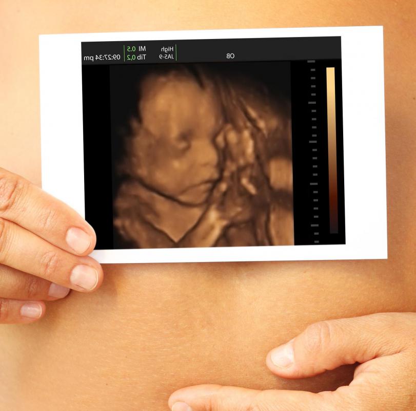 The hemoglobin of unborn babies has a higher affinity for oxygen than the hemoglobin of the mother.