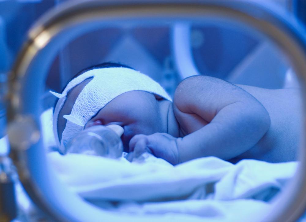 Anise can cause early labor and premature birth.